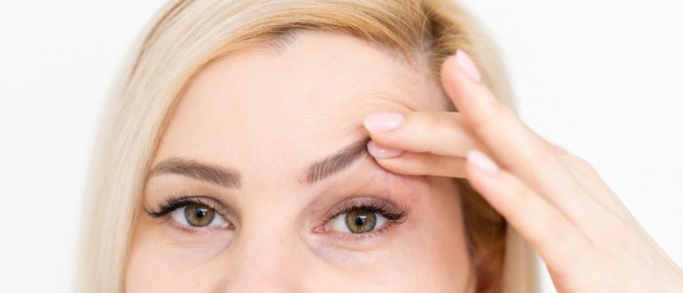 oberlidstraffung-augenlid